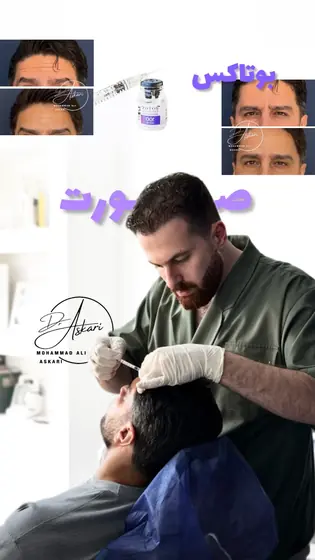 بوتاکس صورت، قبل و بعد، کلینیک زیبایی دکتر عسکری